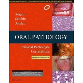 Oral Pathology: Clinical Pathologic Correlations, First South Asia Edition