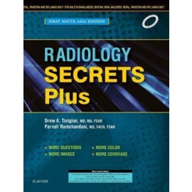 Radiology Secrets: First South Asia Ediiton