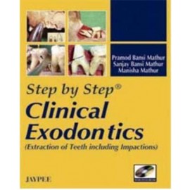 Step by Step Clinical Exodontics (Extraction of Teeth including Impactions) with DVD-ROM