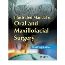Illustrated Manual of Oral and Maxillofacial Surgery