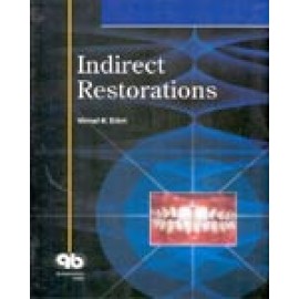 Indirect Restorations