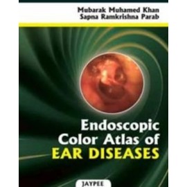Endoscopic Colour Atlas of Ear Diseases