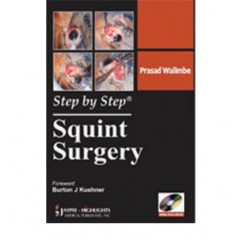 Step by Step Squint surgery