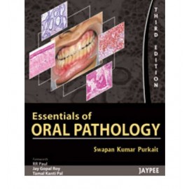 Essential of Oral Pathology