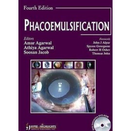 Phacoemulsification 4/e
