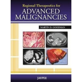 Regional Therapeutics for Advances Malignancies