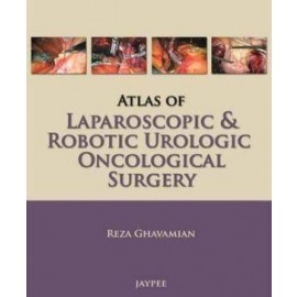 Atlas of Laparoscopic and Robotic Urologic Oncological Surgery