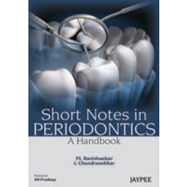 Short Notes in Periodontics: A Handbook