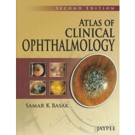 Atlas on Clinical Ophthalmology 2/e
