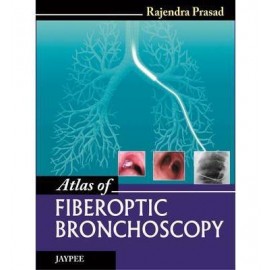 Atlas of Fiberoptic Bronchoscopy