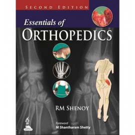 Essentials of Orthopedics 2E
