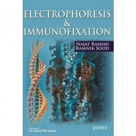 Electrophoresis & Immunofixation