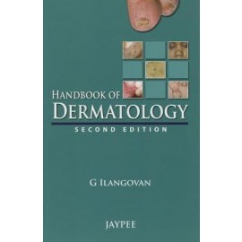 Handbook of Dermatology 2E