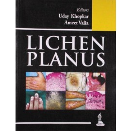 Lichen Planus