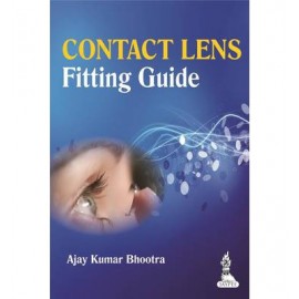 Contact Lens Fitting Guide