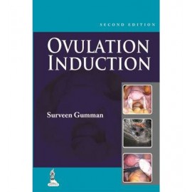 Step by Step Ovulation Induction Includes Interactive CD-ROM 2E