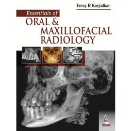 Essentials of Oral and Maxillofacial Radiology
