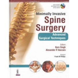 Minimally Invasive Spine Surgery  