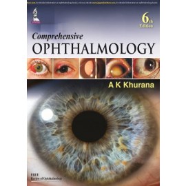 Comprehensive Ophthalmology 6/e