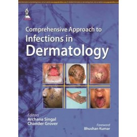 Comprehensive Approach to Infections in Dermatology