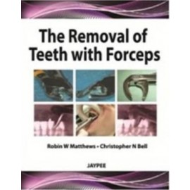 The Removal of Teeth with Forceps