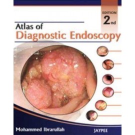 Atlas of Diagnostic Endoscopy 2E