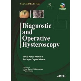 Diagnostic and Operative Hysteroscopy with DVD-ROM 2E