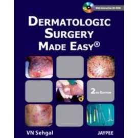 Dermatologic Surgery Made Easy with CD-ROM 2E
