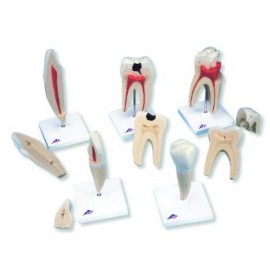 Classic Tooth Model Series, 5 models