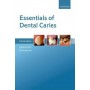 Essentials of Dental Caries 4/e