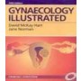 Gynaecology Illustrated, 5e **
