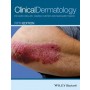 Clinical Dermatology, 5e