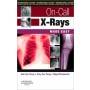 On-Call X-Rays Made Easy, IE