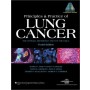 Principles and Practice of Lung Cancer 4e