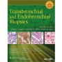 Transbronchial and Endobronchial Biopsies