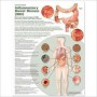 Understanding Inflammatory Bowel Disease (IBD) Chart
