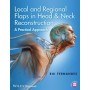 Local and Regional Flaps in Head & Neck Reconstruction: A Practical Approach