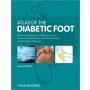 Atlas of the Diabetic Foot, 2e