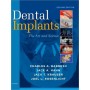 Dental Implants, 2e **