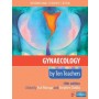 Gynaecology by Ten Teachers, 19e