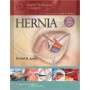 Master Techniques in General Surgery: Hernia Surgery