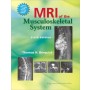MRI of the Musculoskeletal System, 6e