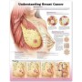 Understanding Breast Cancer Chart 3E