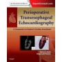 Perioperative Transesophageal Echocardiography, A Companion to Kaplan Cardiac Anesthesia