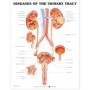 Diseases of the Urinary Tract Chart