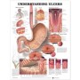 Understanding Ulcers Chart