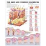The Skin and Common Disorders Chart