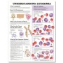 Understanding Leukemia Chart