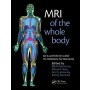 MRI of the Whole Body