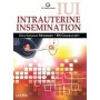 IUI Intrauterine Insemination